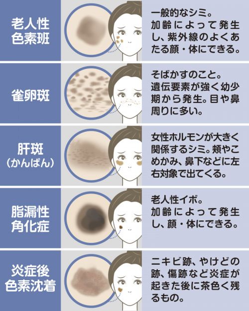 記事番号:2302/アイテムID:5619335の画像