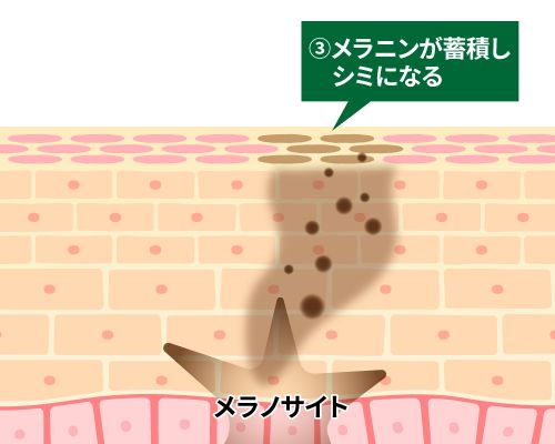 記事番号:2302/アイテムID:5620803の画像