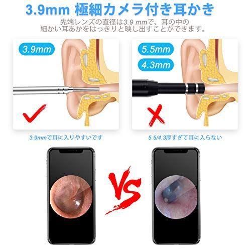 21年最新版 イヤースコープのおすすめ人気ランキング10選 よく見える高画質 セレクト Gooランキング